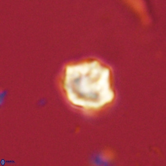 Olladiscoaster catinatus VR 18348