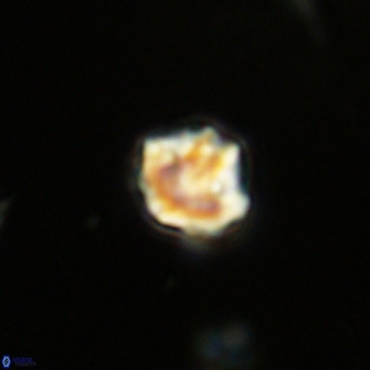 Olladiscoaster catinatus VR 18349