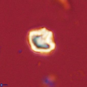Olladiscoaster catinatus VR 18351