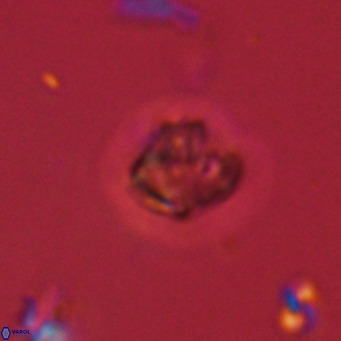 Olladiscoaster catinatus VR 18352