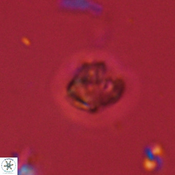 Olladiscoaster catinatus VR 18352