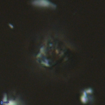 Olladiscoaster catinatus VR 18353