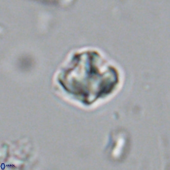 Olladiscoaster catinatus VR 18354