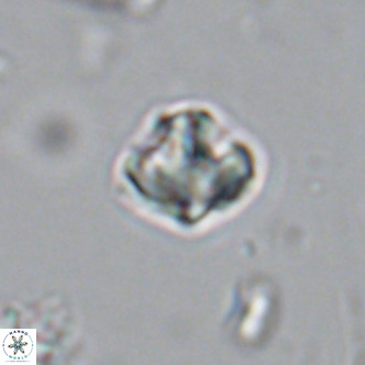 Olladiscoaster catinatus VR 18354