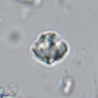 Olladiscoaster catinatus VR 18355