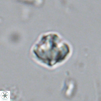 Olladiscoaster catinatus VR 18355