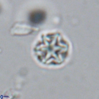 Olladiscoaster catinatus VR 18357