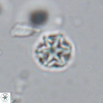 Olladiscoaster catinatus VR 18357