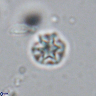 Olladiscoaster catinatus VR 18359