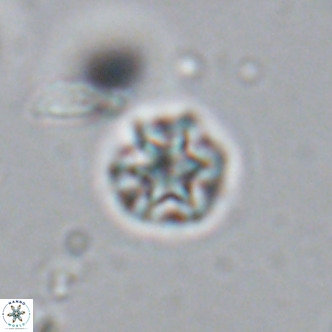 Olladiscoaster catinatus VR 18359