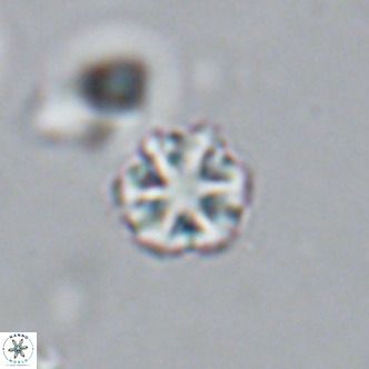 Olladiscoaster catinatus VR 18360