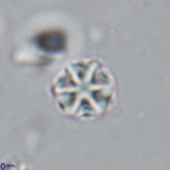Olladiscoaster catinatus VR 18361