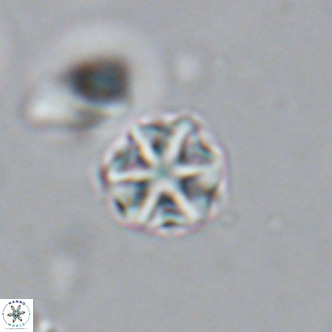 Olladiscoaster catinatus VR 18361
