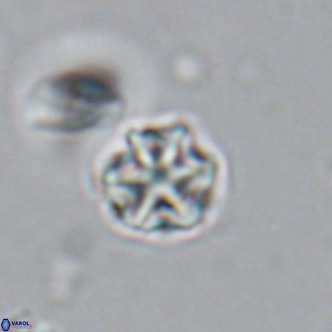 Olladiscoaster catinatus VR 18362