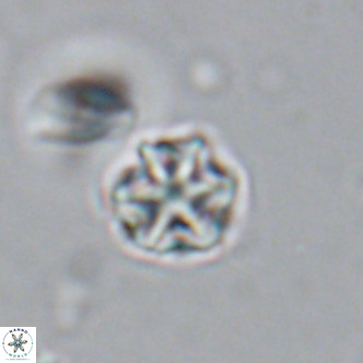 Olladiscoaster catinatus VR 18362