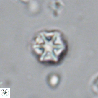 Olladiscoaster catinatus VR 18364