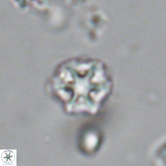Olladiscoaster catinatus VR 18365