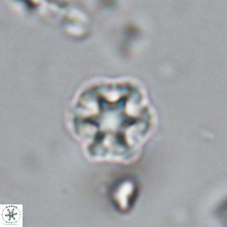 Olladiscoaster catinatus VR 18366