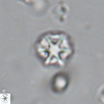 Olladiscoaster catinatus VR 18367