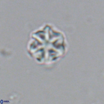 Olladiscoaster catinatus VR 18368