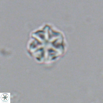 Olladiscoaster catinatus VR 18368