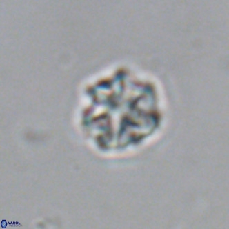 Olladiscoaster catinatus VR 18369