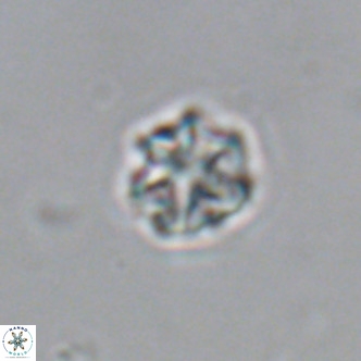 Olladiscoaster catinatus VR 18369