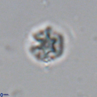 Olladiscoaster catinatus VR 18370