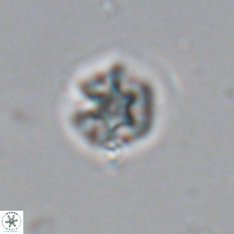 Olladiscoaster catinatus VR 18370