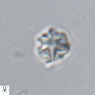 Olladiscoaster catinatus VR 18371