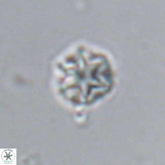 Olladiscoaster catinatus VR 18372