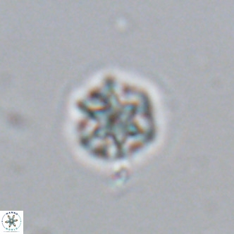 Olladiscoaster catinatus VR 18375