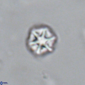 Olladiscoaster catinatus VR 18378