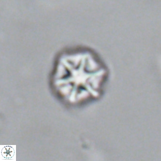 Olladiscoaster catinatus VR 18378