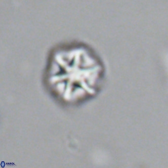 Olladiscoaster catinatus VR 18380