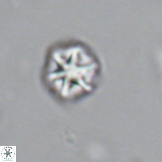 Olladiscoaster catinatus VR 18380