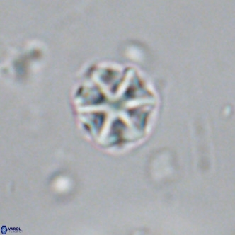 Olladiscoaster catinatus VR 18381
