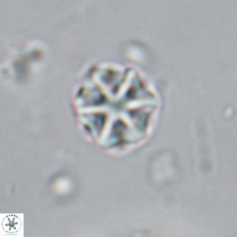 Olladiscoaster catinatus VR 18381