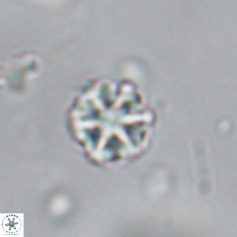 Olladiscoaster catinatus VR 18382