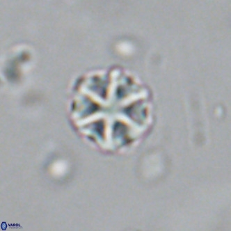 Olladiscoaster catinatus VR 18385