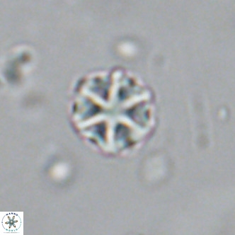 Olladiscoaster catinatus VR 18385
