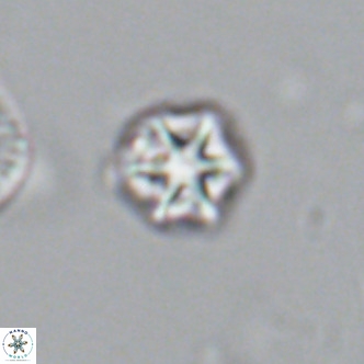 Olladiscoaster catinatus VR 18386