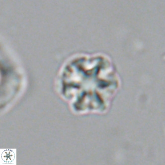 Olladiscoaster catinatus VR 18387