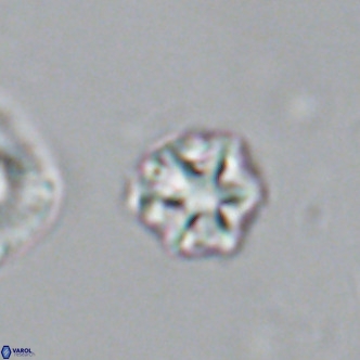 Olladiscoaster catinatus VR 18388