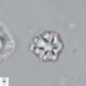 Olladiscoaster catinatus VR 18388
