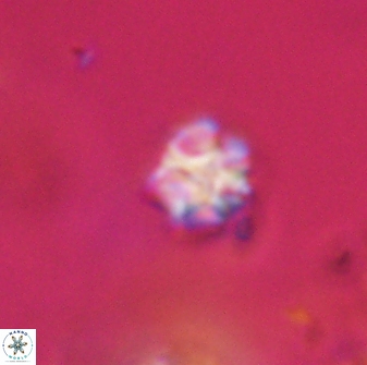Olladiscoaster cruzii 28614