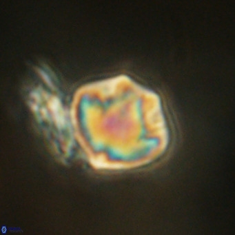 Olladiscoaster exagonikoasteri VR 18964