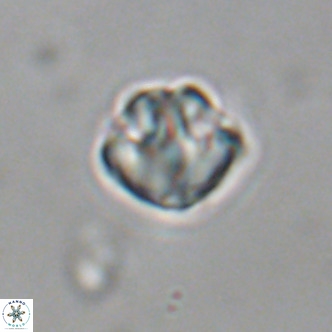 Discoaster puvillandii VR 18985