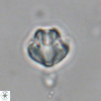 Discoaster puvillandii VR 18986