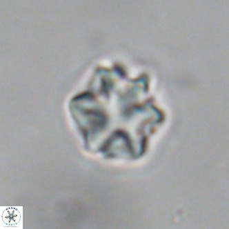 Discoaster puvillandii VR 18987